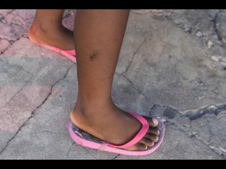 The four-year-old girl who was shot several times on Water Street in May 2021 has now recovered. She was among three persons who were injured in a gun attack targeting an east Kingston woman.