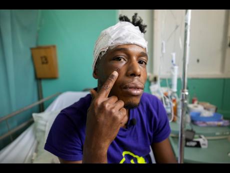 Lamar Nephew, in his hospital room at the University Hospital of the West Indies, Mona, shows the scar left after a high-risk medical procedure that saved his life.