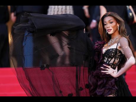 Canadian-born Winnie Harlow, who has Jamaican roots, poses for photographers in Zuhair Murad Couture.
