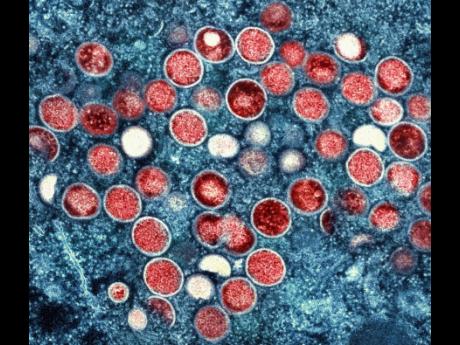 This image provided by the National Institute of Allergy and Infectious Diseases shows a colorised transmission electron micrograph of monkeypox particles (red) found within an infected cell (blue), cultured in the laboratory that was captured and color-en